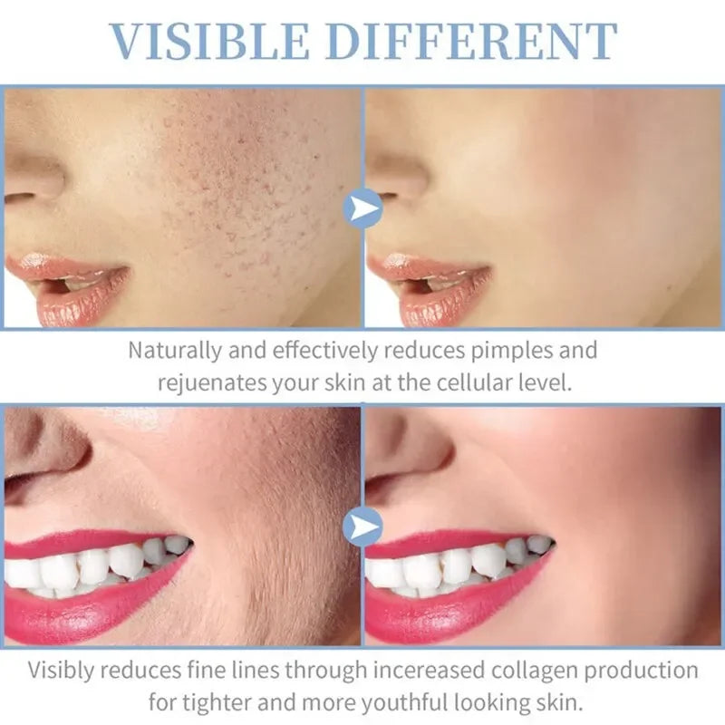 Professional 4-in-1 High Frequency Wand